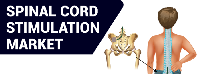 Spinal Cord Stimulation Market Insights