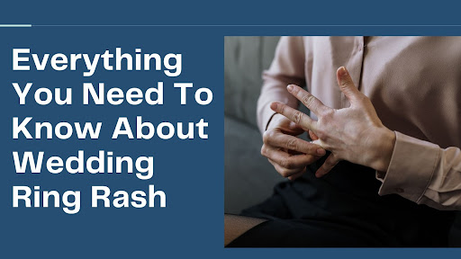 About Wedding Ring Rash