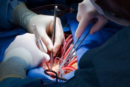 Best Hospital In India For Aortic Valve Replacement Surgery
