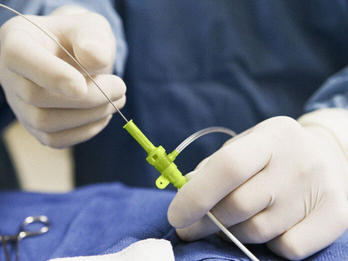 Everything You Need to Know About Cardiac Catheterization