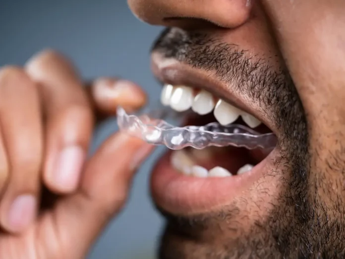 5 Ways to Stop Clenching Your Teeth